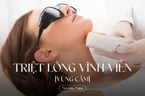 Triệt lông vùng cằm vĩnh viễn